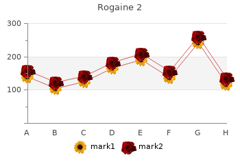 purchase discount rogaine 2 on line
